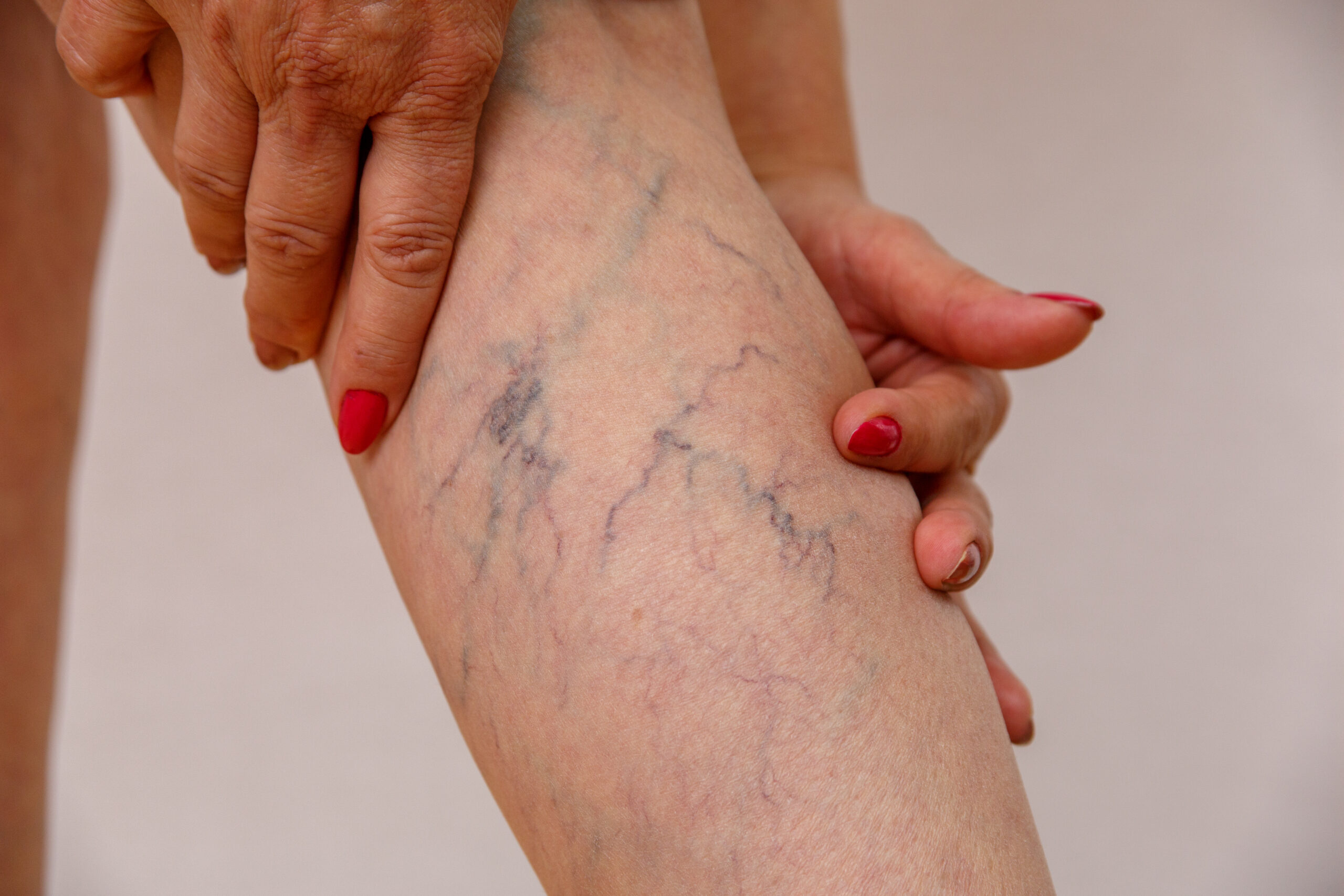 Harvard Trained Vein Doctor How Can I Find The Best Vein Clinic Near 