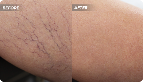 VTCBefore-After-12_1