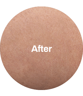 BEFORE_AFTER BEFORE_AFTER-min