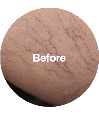 BEFORE_AFTER_2 BEFORE_AFTER_2-min