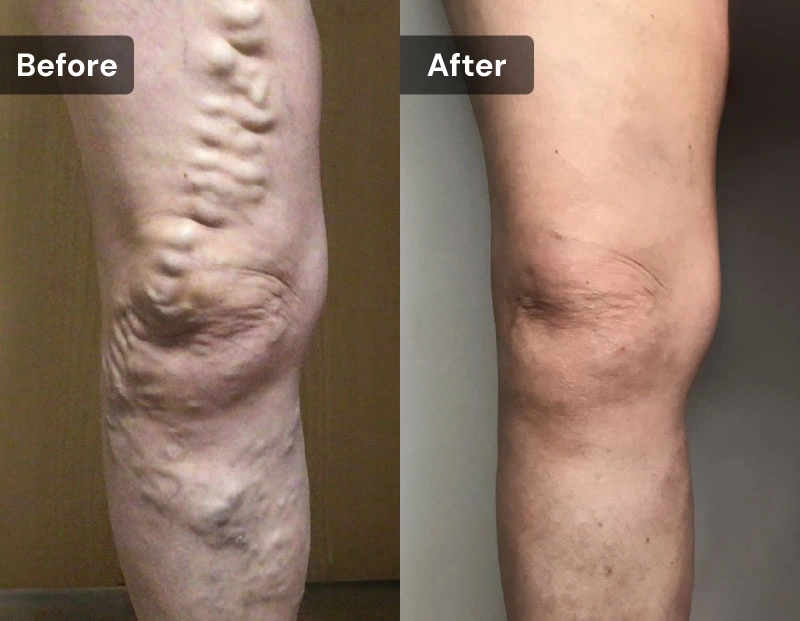 VCLNY & VTC NY Banners BA Horizontal