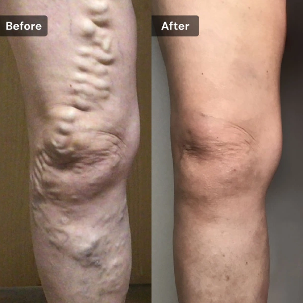 VCLNY-&-VTC-NY-Banners_BA VCLNY-&-VTC-NY-Banners_BA